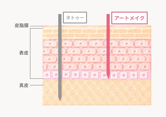 タトゥーとアートメイクの着色層の違い